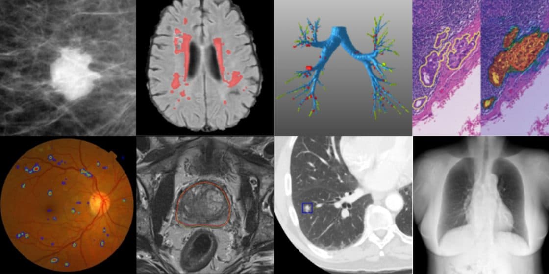 AI and the Transformation of the Medical World