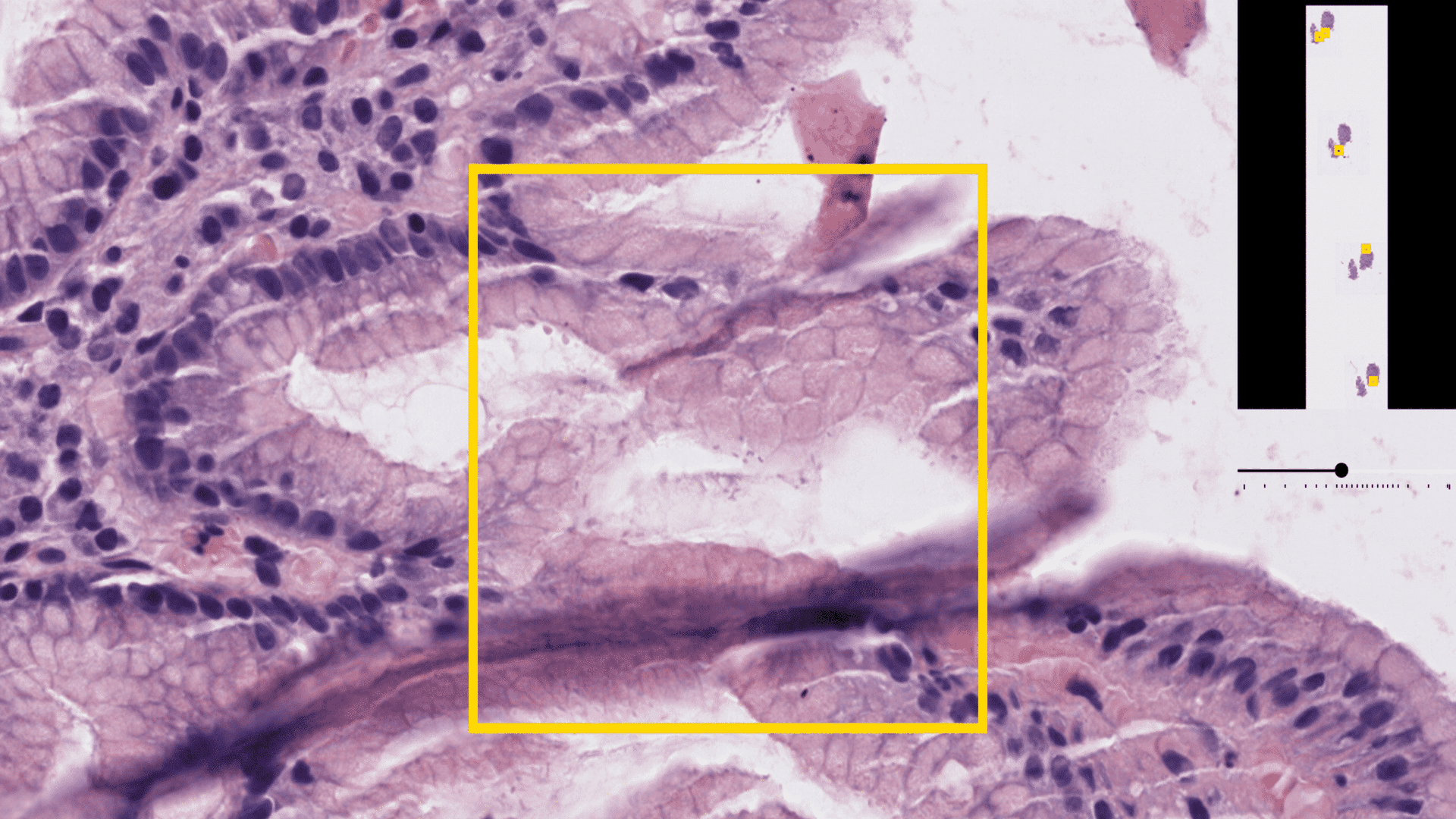 This Israeli Startup Is Using AI To Revolutionize Pathology