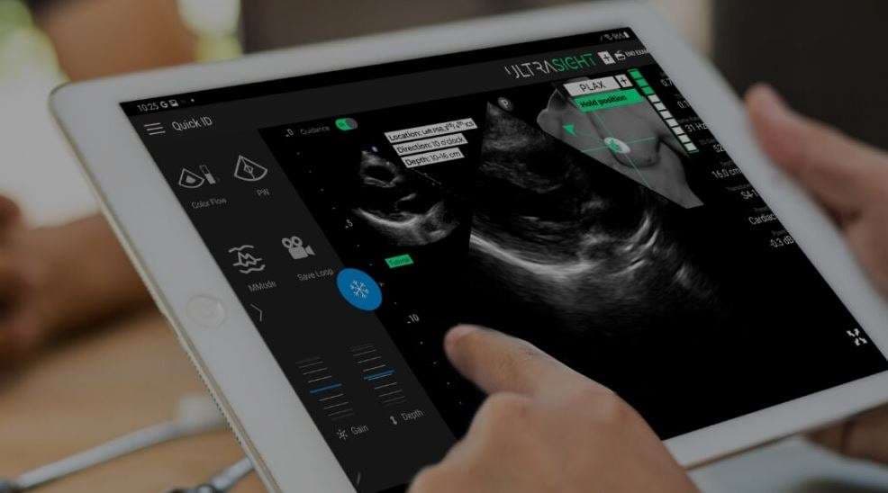 ultrasight cardiac ultasound imaging. credit - ultrasight